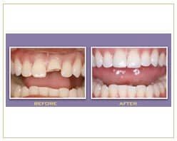 Slider image (2) PrimaDent Dental Center